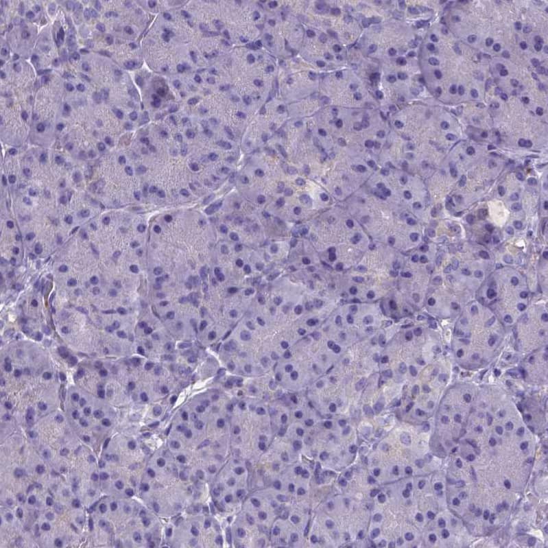 Staining of human pancreas shows no positivity in exocrine glandular cells as expected.