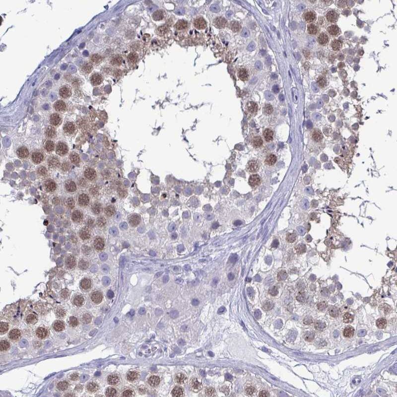 Immunohistochemistry-Paraffin TEX12 Antibody - BSA Free