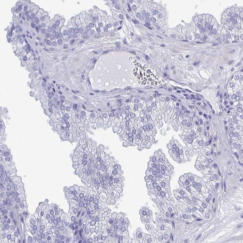 Immunohistochemistry-Paraffin TEX12 Antibody - BSA Free