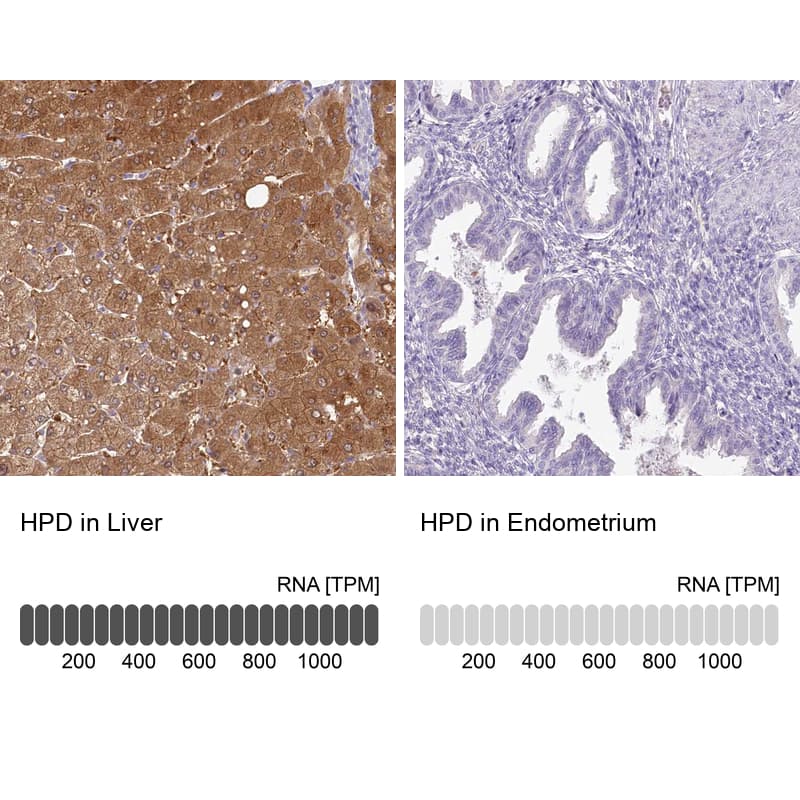 <b>Independent Antibodies Validation and Orthogonal Strategies Validation.</b>Analysis in human liver and endometrium tissues. Corresponding RNA-seq data are presented for the same tissues.