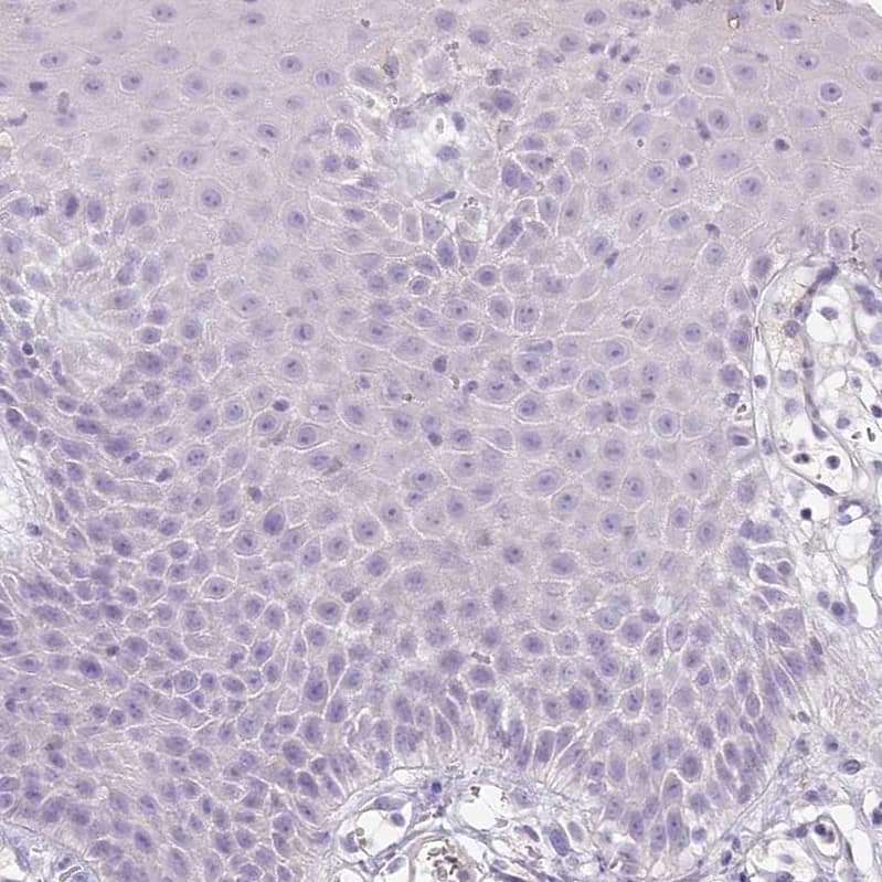 Staining of human squamous epithelia shows no positivity in squamous epithelial cells as expected.