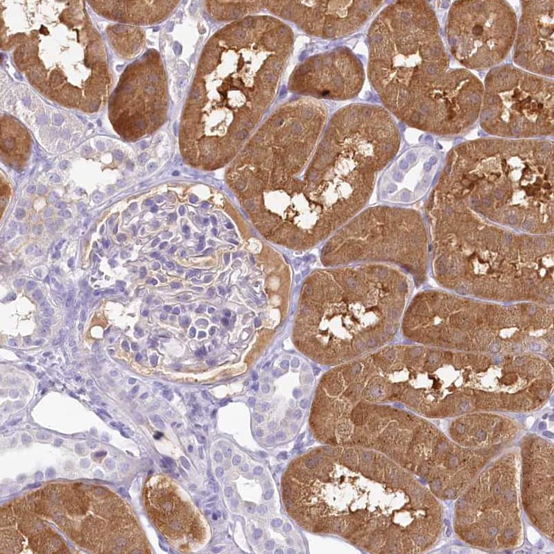 Staining of human kidney shows strong cytoplasmic positivity in cells in tubules.