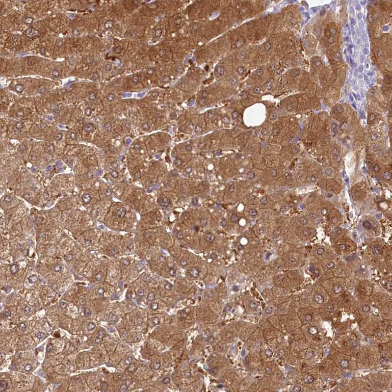 Staining of human liver shows strong cytoplasmic positivity in hepatocytes.