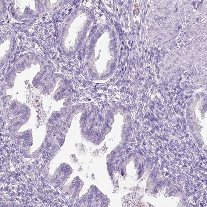 Staining of human endometrium shows no positivity in glandular cells as expected.
