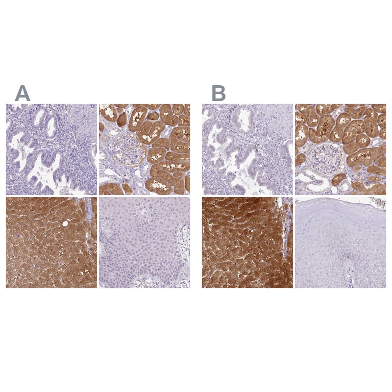 <b>Orthogonal Strategies Validation. </b>Staining of human endometrium, kidney, liver and squamous epithelia HPA038321 (A) shows similar protein distribution across tissues to independent antibody HPA038322 (B).
