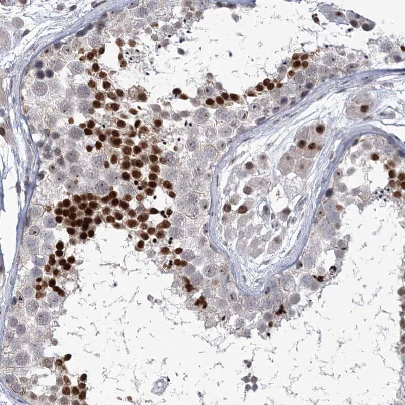 Staining of human testis shows strong nuclear positivity in subset of cells in seminiferus ducts.