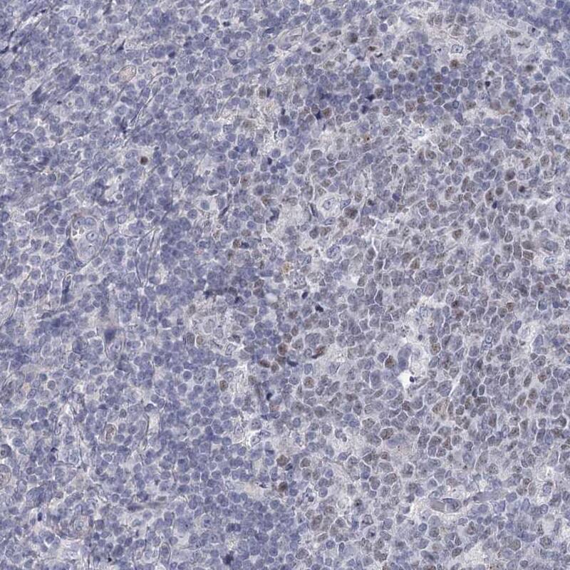 Staining of human tonsil shows nuclear positivity in germinal center cells.