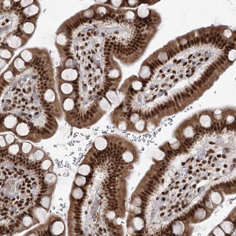 Staining of human small intestine shows strong nuclear positivity in glandular cells.
