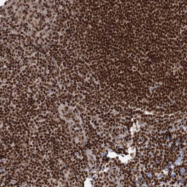 Staining of human tonsil shows strong nuclear positivity in non-germinal center cells.