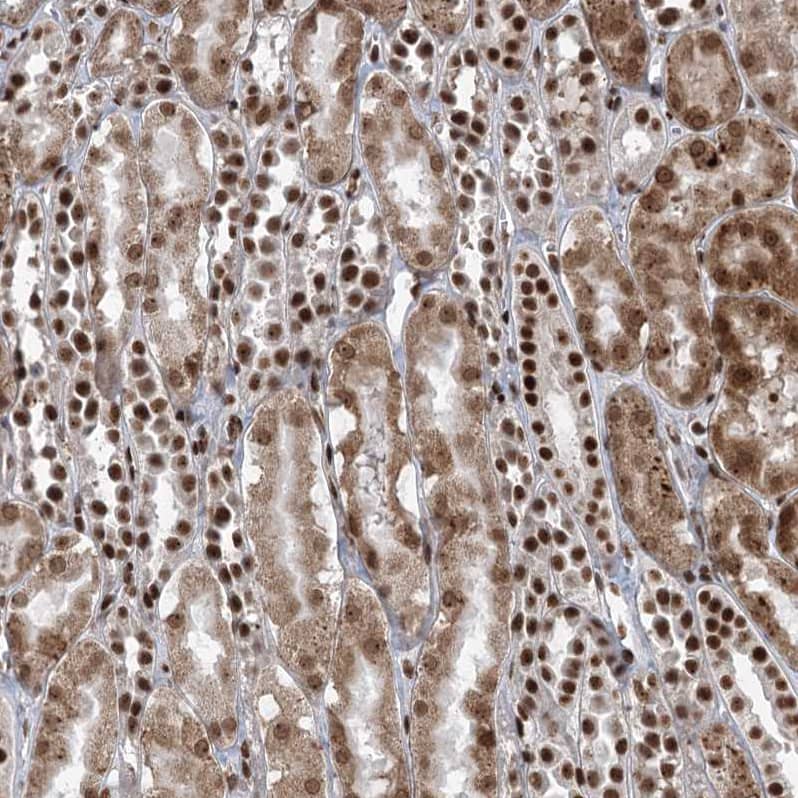 Staining of human kidney shows strong nuclear positivity in cells in tubules.