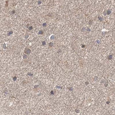 Immunohistochemistry-Paraffin DDO Antibody - BSA Free