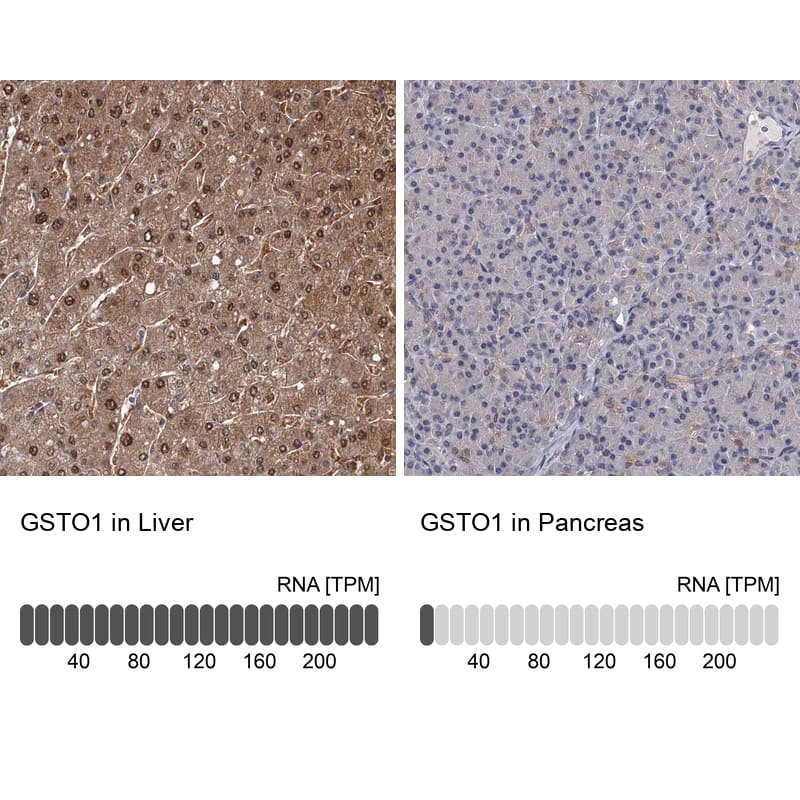 Immunohistochemistry-Paraffin GSTO1 Antibody - BSA Free