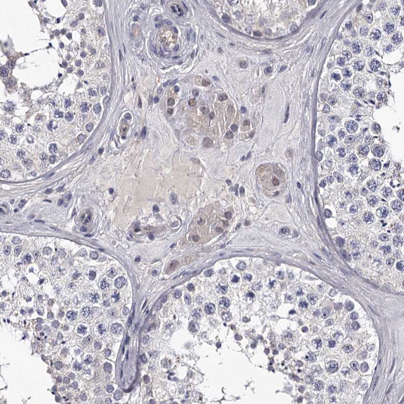 Staining of human testis shows weak cytoplasmic positivity in Leydig cells as expected.