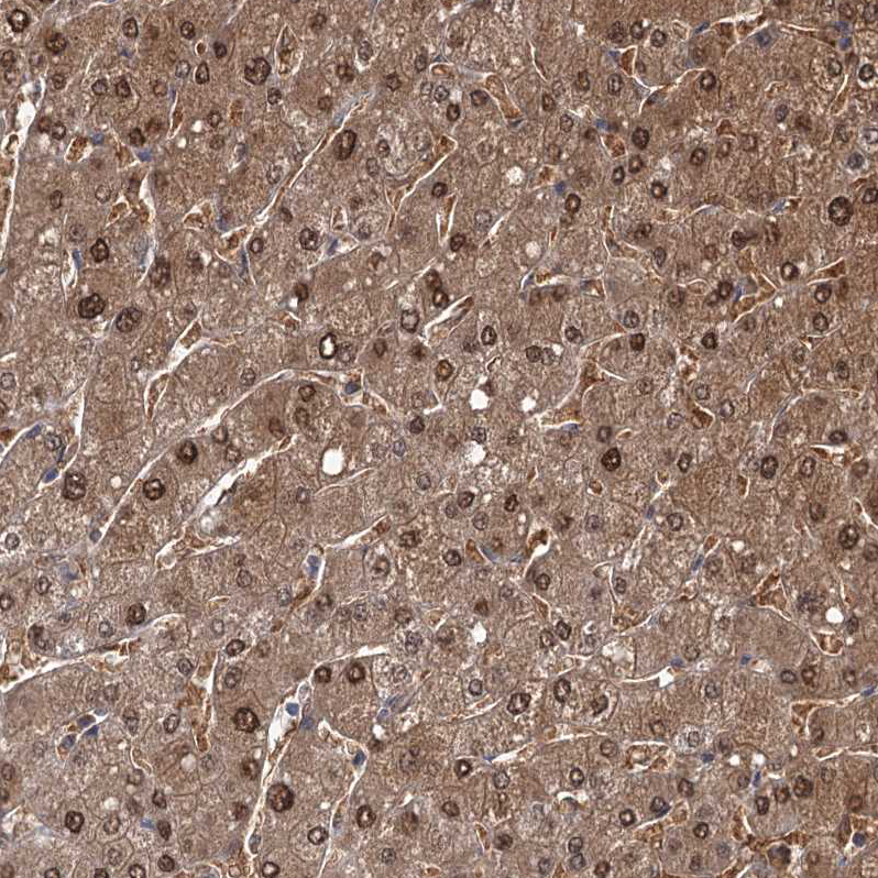 Staining of human liver shows strong cytoplasmic and nuclear positivity in hepatocytes.