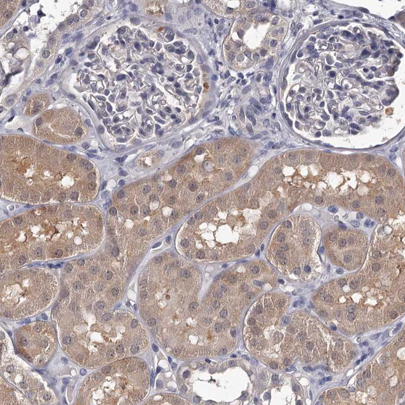 Staining of human kidney shows moderate cytoplasmic positivity in cells in tubules.