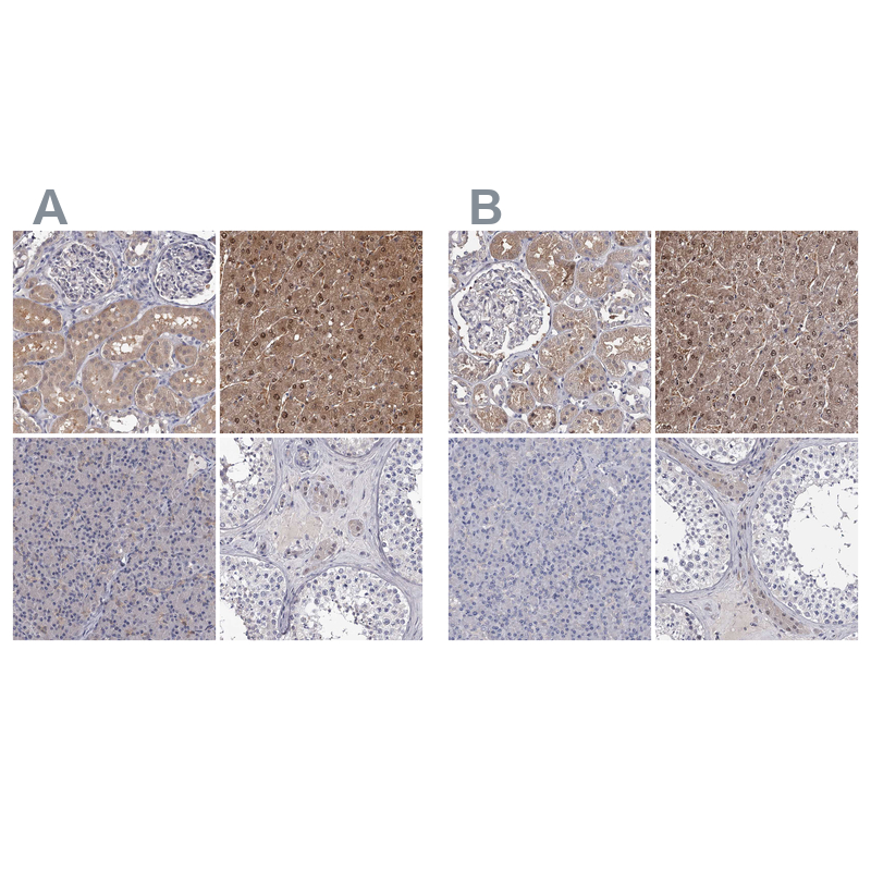 Staining of human kidney, liver, pancreas and testis HPA037603 (A) shows similar protein distribution across tissues to independent antibody HPA037604 (B).