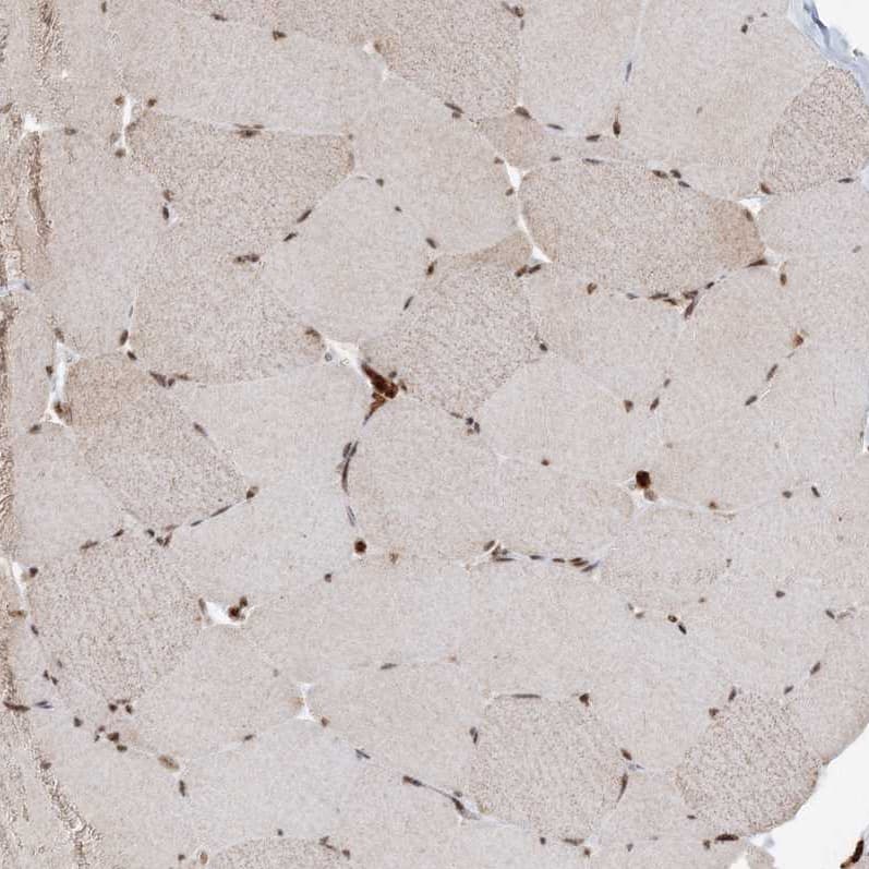 Immunohistochemistry-Paraffin QRICH1 Antibody - BSA Free