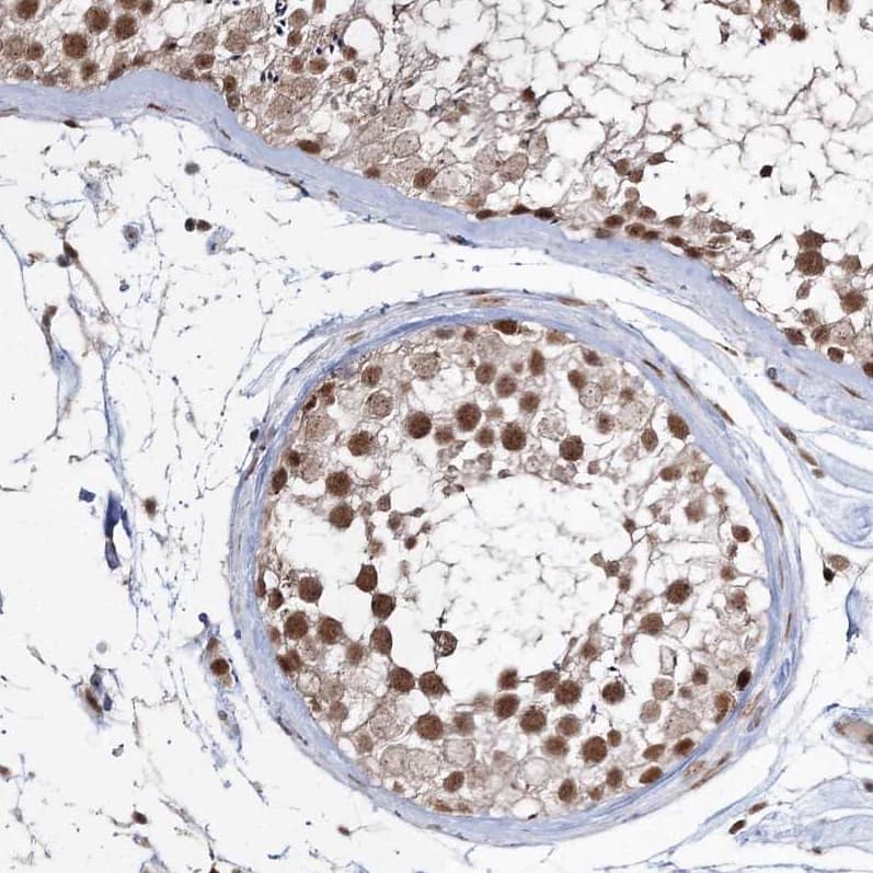 Immunohistochemistry-Paraffin QRICH1 Antibody - BSA Free