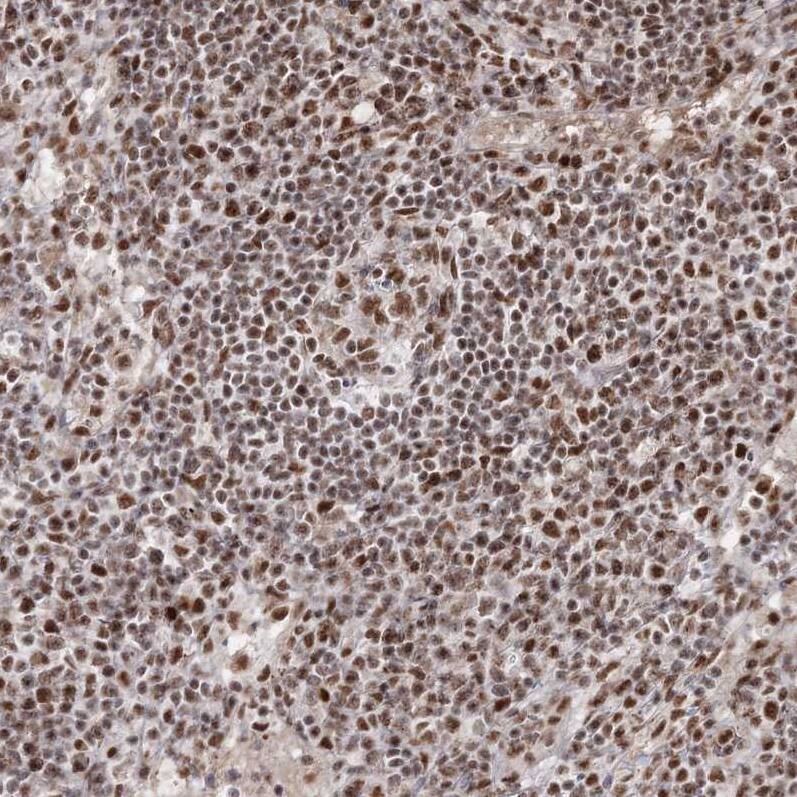 Immunohistochemistry-Paraffin QRICH1 Antibody - BSA Free