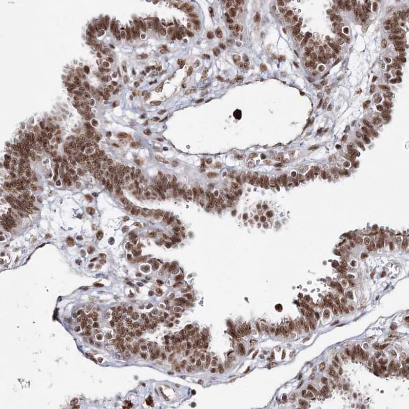 Immunohistochemistry-Paraffin QRICH1 Antibody - BSA Free