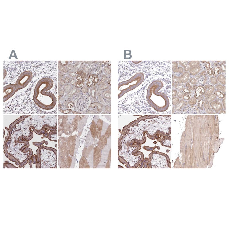 Staining of human endometrium, kidney, placenta and skeletal muscle HPA037685 (A) shows similar protein distribution across tissues to independent antibody HPA037686 (B).