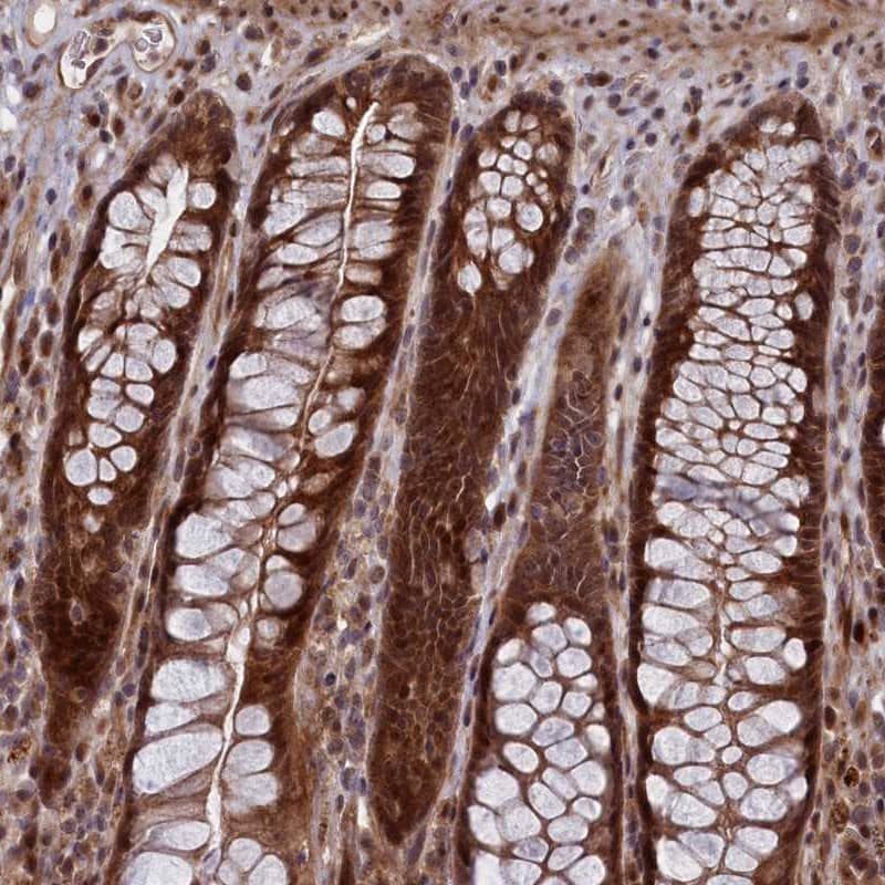 <b>Independent Antibodies Validation. </b>Staining of human rectum shows strong cytoplasmic and nuclear positivity in glandular cells.