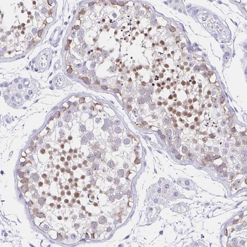 Staining of human testis shows high expression.