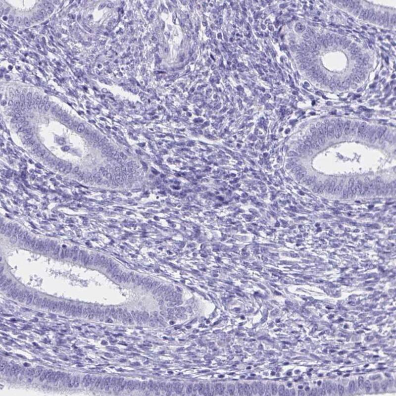 Staining of human endometrium shows low expression as expected.