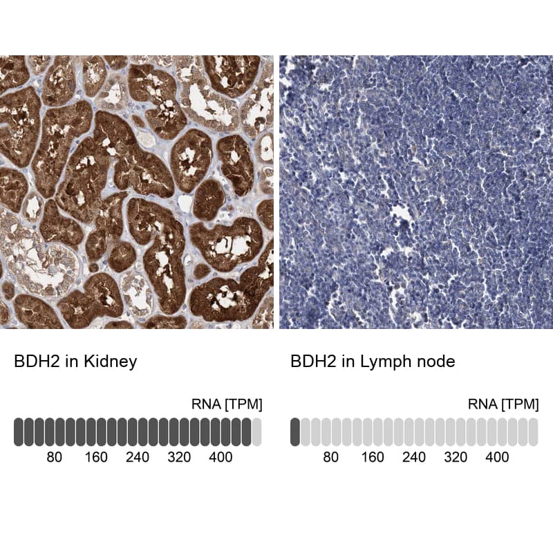 Immunohistochemistry-Paraffin BDH2 Antibody - BSA Free