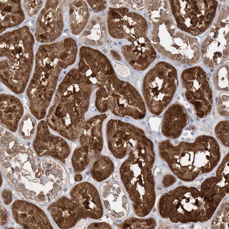 Immunohistochemistry-Paraffin BDH2 Antibody - BSA Free