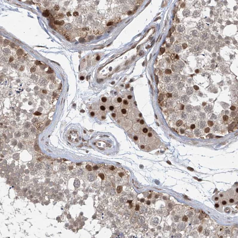 Staining of human testis shows strong nuclear positivity in Leydig cells.