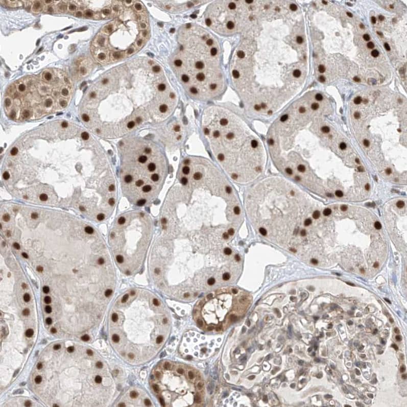 Staining of human kidney shows strong nuclear positivity in cells in tubules.