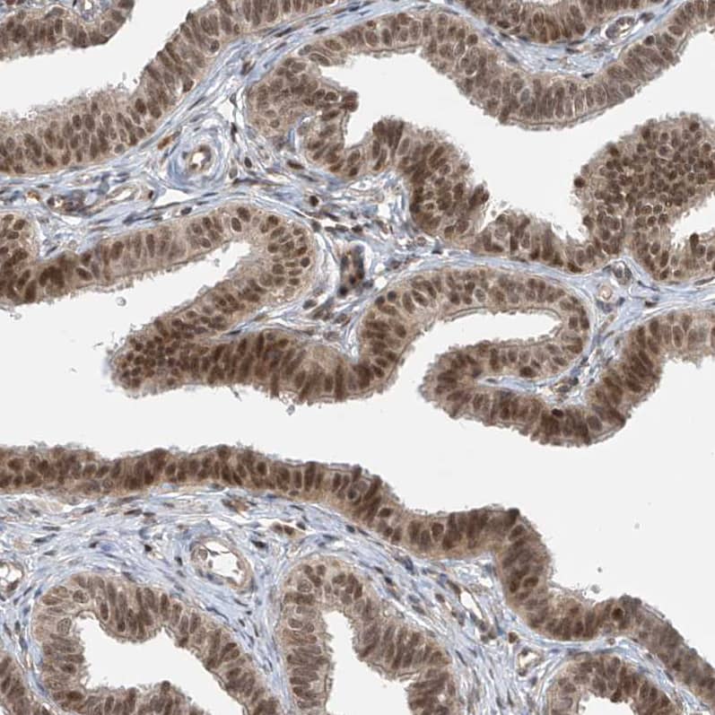Staining of human fallopian tube shows moderate to strong nuclear positivity in glandular cells.