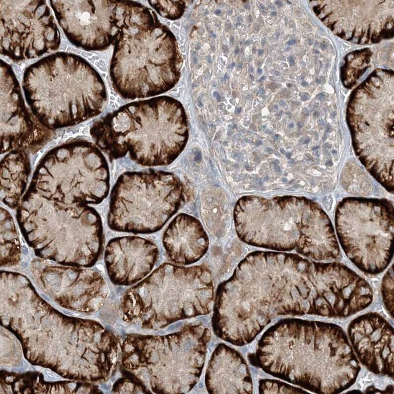 Staining of human kidney shows strong cytoplasmic positivity in cells in tubules.