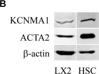 Large-conductance and Ca2+-activated K+ (BK) channels are expressed and functional in activated hepatic stellate cells (HSCs). (A,B) Representative RT-qPCR (A) and western blots (B) showing the expression of ACTA2 and the BK channels alpha subunit KCNMA1 in activated human LX2 cells treated with transforming growth factor beta 1 (TGF beta 1) and spontaneously activated primary rat HSCs in vitro. (C) Representative immunofluorescence images of KCNMA1 and ACTA2 in activated primary rat HSCs (Scale bars, 25 μm). (D,E) Representative whole-cell K+ current traces and the normalized current recorded from activated HSCs before and after treatment with rottlerin (Rot) and paxilline (Pax), as indicated at 1 μM internal Ca2+. The whole-cell currents were elicited by 1 s voltage ramps from −100 to 80 mV. Rottlerin (1 μM) and paxilline (10 μM) were freshly prepared from stock solutions and the final DMSO concentration was 0.1% (*p < 0.05 compared with the vehicle group, n = 3). Image collected and cropped by CiteAb from the following open publication (//pubmed.ncbi.nlm.nih.gov/32210801), licensed under a CC-BY license. Not internally tested by Novus Biologicals.