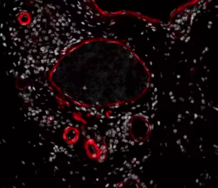 Immunohistochemistry-Paraffin: alpha-Smooth Muscle Actin Antibody (1A4/asm-1) [Alexa Fluor® 532] [NBP2-33006AF532] - aSMA stained over night in human FFPE tonsil section ((Catalog # NBP2-33006AF750)). Heat mediated antigen retrieval at pH 9. 1:50 Dilution in 3% BSA, incubation over night at 4 °C. Image from a verified customer review.