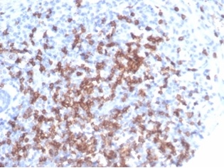 Formalin-fixed, paraffin-embedded human tonsil stained with CD8 antibody at 2ug/ml at RT. HIER: Tris/EDTA, pH9.0, 45min. Secondary: HRP-polymer, 30min. DAB, 5min.