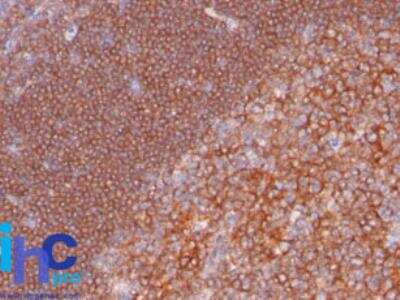 Immunohistochemistry-Paraffin: CD19 Antibody (C19/366) - Azide and BSA Free [NBP2-33194] - Formalin-fixed, paraffin-embedded human tonsil tissue stained with CD19 C19/366 antibody at 1:100 using peroxidase-conjugate and DAB chromogen. Note specific membrane staining.