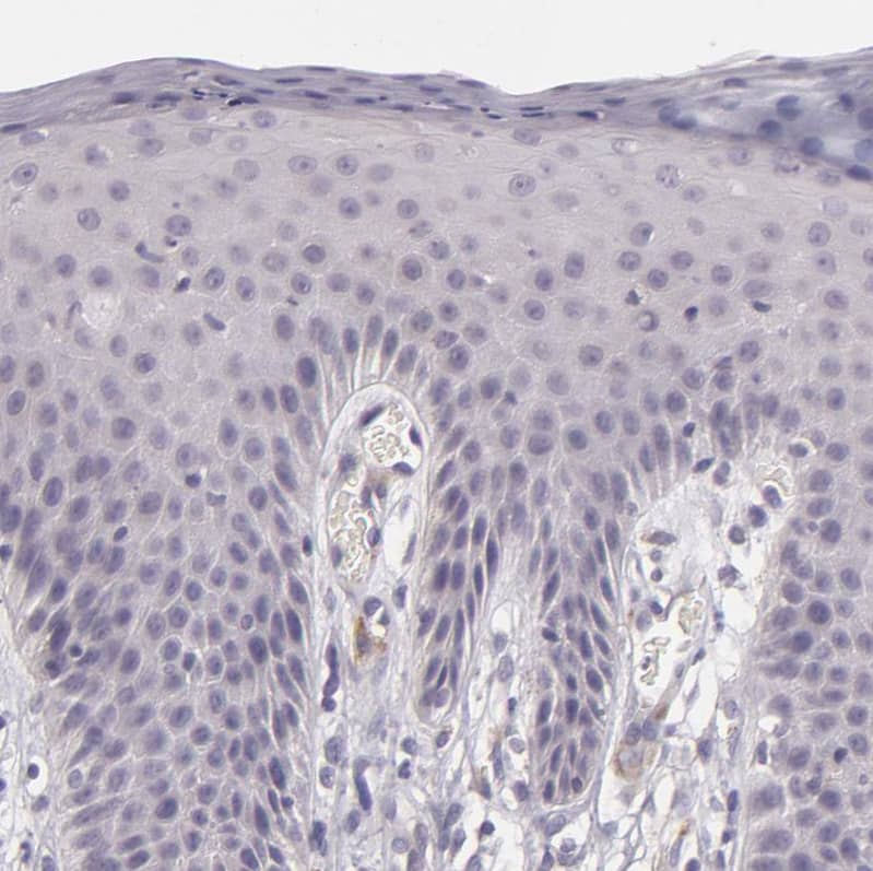 Staining of human skin shows no positivity in squamous epithelial cells as expected.