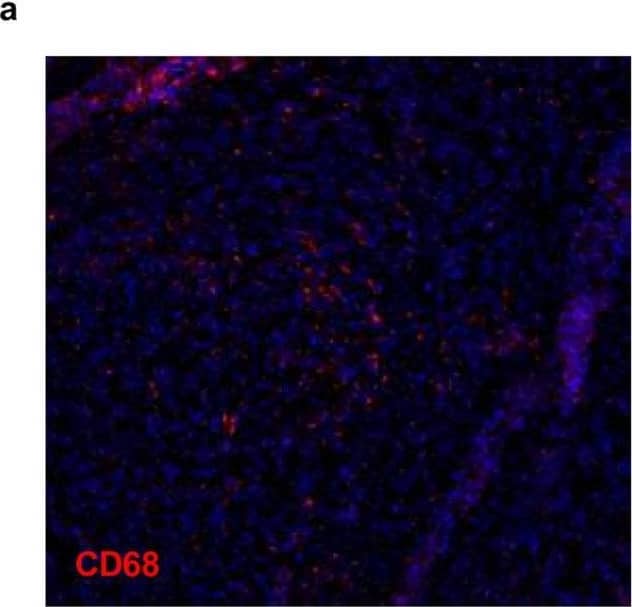 Detection of CD68 + cells within the TIM(E) (a) Representative image of tissue sections labeled anti-CD68 for macrophages. (b) Comparison between total macrophages among the tumors obtained from the BL/6nA group compared to those obtained from the BL/6nB group. (c) Comparison between macrophages populations present in each tumor regions for the BL/6nA and BL/6nB groups. Spleen. Macrophage staining control in spleen cut. ***P < 0.001. Image collected and cropped by CiteAb from the following open publication (//pubmed.ncbi.nlm.nih.gov/38956203), licensed under a CC-BY license. Not internally tested by Novus Biologicals.
