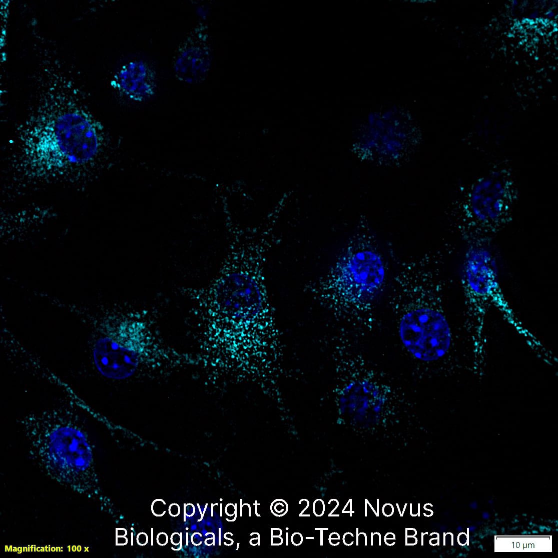 CD68/SR-D1 (FA-11) was detected in immersion fixed Raw 264.7 mouse macrophage cell line using Rat anti-CD68/SR-D1 (FA-11) Protein-G purified Monoclonal Antibody conjugated to Alexa Fluor® 647 (Catalog # NBP2-33337AF647) (light blue) at 10 µg/mL overnight at 4C. Cells were counterstained with DAPI (blue). Cells were imaged using a 100X objective and digitally deconvolved.    