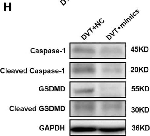 Western Blot: GSDMDC1 Antibody [NBP2-33422] - Overexpression of miR-513c-5p suppresses pyroptosis of VECs & DVT formation by inhibiting caspase-1. (A) Expression of miR-513c-5p in vascular tissue was detected by qRT-PCR in DVT mice treated with NC, miR-513c-5p mimics, respectively. (B) Relative expression of miR-513c-5p was measured by qRT-PCR in PBMCs of DVT each treatment group. (C) Confocal microscopy images of miR-513c-5p expression in vascular tissues (miR-513c-5p, red; DAPI, blue) (magnification, ×200). Scale bars = 100 μm. (D) H&E staining of serial cross sections of inferior vena cava (IVC) from DVT mice treated with NC, miR-513c-5p mimics at 48 h (magnification, ×40), respectively. Scale bars = 500 μm. (E) Representative images of thrombi in each treatment group were detected by vascular ultrasound at 48 h post-operation. (F) Thrombus length & weight at 48 h post-operation in DVT mice (n = 15) treated with NC, miR-513c-5p mimics. (G) Caspase-1 mRNA level was determined by qRT-PCR in vascular tissue of each treatment group. (H) Caspase-1 & GSDMD protein levels were determined by Western blot in vascular tissue of DVT each treatment group. (I) IL-1 beta  & IL-18 protein levels in vascular tissue were determined by ELISA in DVT each treatment group. **p < 0.01, ***p < 0.001, & ****p < 0.0001. Image collected & cropped by CiteAb from the following publication (//pubmed.ncbi.nlm.nih.gov/35445025), licensed under a CC-BY license. Not internally tested by Novus Biologicals.