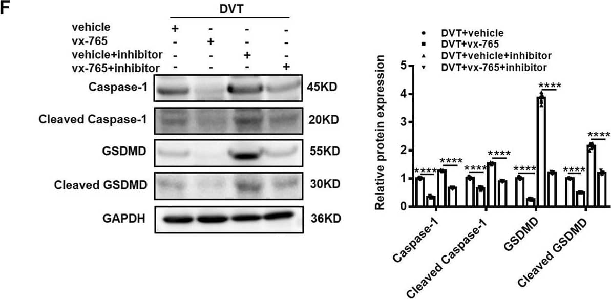 Western Blot: GSDMDC1 Antibody [NBP2-33422] - Caspase-1 inhibitor (vx-765) inhibits the formation of DVT in vivo. (A,B) H&E staining of serial cross sections of IVC from Ctrl, Sham, DVT, DVT+vehicle, DVT+vx-765, DVT+vehicle+miR-513c-5p inhibitor, DVT+vx-765+miR-513c-5p inhibitor at 48 h (magnification, ×40). Scale bars = 500 μm. (C,D) Thrombus length & weight at 48 h post-operation in the different treatment groups after the administration of caspase-1 inhibitor (vx-765) (n = 15 in each group). (E) Representative images of thrombi in each treatment group were detected by vascular ultrasound at 48 h post-operation. (F) Caspase-1 & GSDMD protein levels were determined by Western blot in vascular tissue of DVT animal group & vx-765-treated groups. (G) Expression of IL-1 beta  & IL-18 in vascular tissue were detected by ELISA with vx-765 treated each group. **p < 0.01, ***p < 0.001, ****p < 0.0001. Image collected & cropped by CiteAb from the following publication (//pubmed.ncbi.nlm.nih.gov/35445025), licensed under a CC-BY license. Not internally tested by Novus Biologicals.