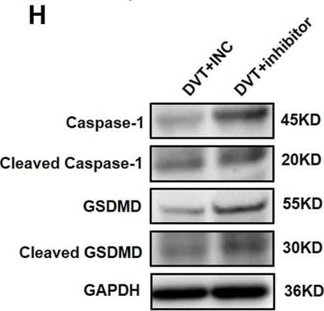 Western Blot: GSDMDC1 Antibody [NBP2-33422] - Knockdown of miR-513c-5p promotes pyroptosis of VECs & DVT formation by increasing caspase-1. (A) The expression level of miR-513c-5p in vascular tissue was detected by qRT-PCR in DVT mice treated with INC, miR-513c-5p inhibitor, respectively. (B) Expression of miR-513c-5p in PBMCs was detected by qRT-PCR in DVT mice treated with INC, miR-513c-5p inhibitor, respectively. (C) Confocal microscopy images of miR-513c-5p expression in vascular tissues (miR-513c-5p, red; DAPI, blue) (magnification, ×200). Scale bars = 100 μm. (D) H&E staining of serial cross sections of inferior vena cava (IVC) from DVT mice treated with INC, miR-513c-5p inhibitor at 48 h (magnification, ×40). Scale bars = 500 μm. (E) Representative images of thrombi in each treatment group were detected by vascular ultrasound at 48 h post-operation. (F) Thrombus length & weight at 48 h post-operation in the different treatment groups (n = 15 in each group). (G) Caspase-1 mRNA level was determined by qRT-PCR in vascular tissue of each treatment group. (H) Caspase-1 & GSDMD protein levels were determined by Western blot in vascular tissue of DVT mice treated with INC, miR-513c-5p inhibitor. (I) IL-1 beta  & IL-18 protein levels in vascular tissue were determined by ELISA in INC, miR-513c-5p inhibitor treated DVT mice models, respectively. *p < 0.05, **p < 0.01, ***p < 0.001, ****p < 0.0001. Image collected & cropped by CiteAb from the following publication (//pubmed.ncbi.nlm.nih.gov/35445025), licensed under a CC-BY license. Not internally tested by Novus Biologicals.