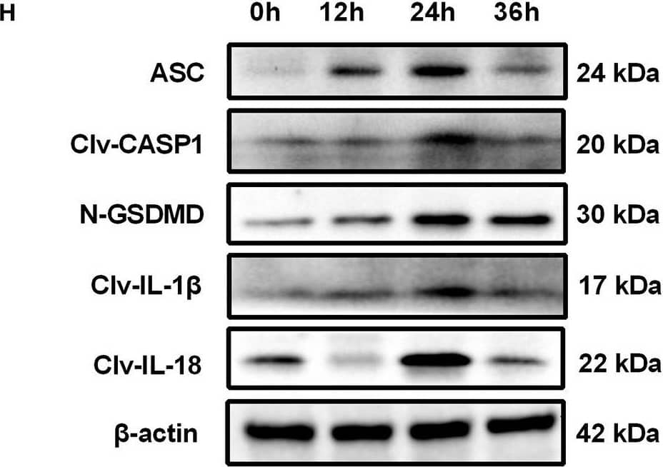 Western Blot: GSDMDC1 Antibody [NBP2-33422] - Heat-killed C. albicans (HKCA) activates NLRP3 inflammasome & induces pyroptosis in human corneal epithelial cells (HCECs). (A) The mRNA expression of NLRP3 in HCECs challenged with HKCA at an MOI of 1:500, 1:50, 1:5, 2:1, or 20:1 respectively for 4 hours was evaluated by RT-qPCR (n = 5). (B–D) The mRNA & protein expression of NLRP3 in HCECs exposed to HKCA (MOI = 20) for 0 (control), 2, 4, 8, 12, or 24 h (n = 3). (E) NLRP3 fluorescence intensity was evaluated using immunofluorescent staining for different times (12–36 h). (n = 3; Scale bar = 20 μm; magnification 400×). (F) Lactate dehydrogenase (LDH) of HCECs treated with HKCA (MOI = 20) for 24 h (n = 6). (G) The mRNA levels of ASC, CASP1, IL-1 beta , IL-18 & GSDMD in HCECs exposed to HKCA (MOI = 20) for different times (n = 3). (H,I) The protein expression of pyroptosis-related proteins (ASC, cleaved CASP1, N-GSDMD, cleaved IL-1 beta  & cleaved IL-18) was examined by western blot (n = 3). CASP1: caspase-1; Clv-CASP1: cleaved CASP1; Clv-IL-1 beta : cleaved IL-1 beta ; Clv-IL-18: cleaved IL-18; N-GSDMD: cleaved p30 form of GSDMD. All values are presented as mean ± SEM. *p < 0.05; **p < 0.01; ***p < 0.001; ****p < 0.0001 vs. control group. Image collected & cropped by CiteAb from the following publication (//pubmed.ncbi.nlm.nih.gov/35463001), licensed under a CC-BY license. Not internally tested by Novus Biologicals.