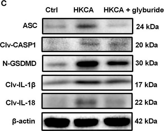 Western Blot: GSDMDC1 Antibody [NBP2-33422] - miR-513c-5p negatively regulates caspase-1 expression in HUVECs. (A) The expression of miR-513c-5p after NC, miR-513c-5p mimics, INC & miR-513c-5p inhibitor transfection was evaluated by qRT-PCR. (B) The expression level of caspase-1 mRNA after NC, miR-513c-5p mimics, INC & miR-513c-5p inhibitor transfection was detected by qRT-PCR. (C,D) Expression of caspase-1 in HUVECs were detected after transfection NC, miR-513c-5p mimics, INC, miR-513c-5p inhibitor by immunofluorescence staining (magnification, ×40). Scale bar = 200 μm. (E,F) Protein expression levels of caspase-1 & GSDMD were examined by Western blot. (G) The expression of IL-1 beta  & IL-18 was detected by ELISA. *p 0.05; *p < 0.05; **p < 0.01; ***p < 0.001; ****p < 0.0001. Image collected & cropped by CiteAb from the following publication (//pubmed.ncbi.nlm.nih.gov/35463001), licensed under a CC-BY license. Not internally tested by Novus Biologicals.