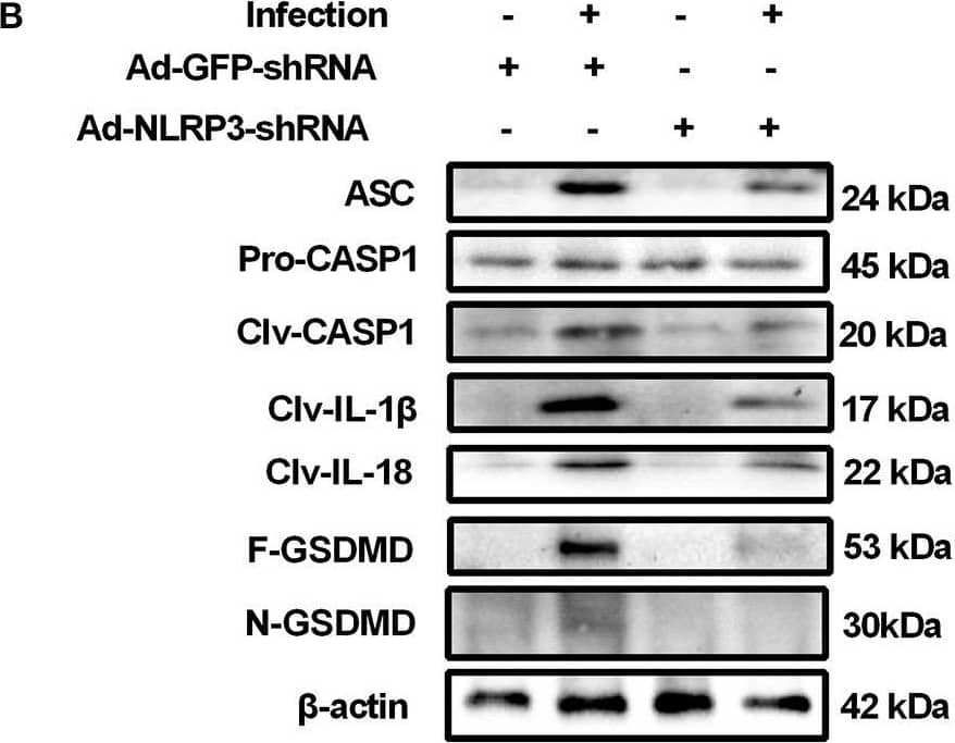 Western Blot: GSDMDC1 Antibody [NBP2-33422] - NLRP3 knockdown attenuates the pyroptosis in mouse C. albicans keratitis. (A–C) RT-qPCR analysis & western blot showing the mRNA & protein levels of pyroptosis-related molecules in C. albicans-infected corneas pretreated with Ad-GFP-shRNA & Ad-NLRP3- shRNA compared with mock controls (n = 3). (D) Immunofluorescence staining of ASC, CASP1 & GSDMD in C. albicans-infected corneas pretreated with Ad-GFP-shRNA & Ad-NLRP3- shRNA compared with mock controls (n = 3). (E) Double-immunofluorescence staining of CASP1 & TUNEL in the mice cornea of Ad-NLRP3-shRNA group compared with the Ad-GFP-shRNA group (n = 3). Scale bar = 20 μm; magnification 400×. FK: fungal keratitis. CASP1: caspase-1; Clv-CASP1:cleaved CASP1; Clv-IL-1 beta :cleaved IL-1 beta ; Clv-IL-18:cleaved IL-18; F-GSDMD: p53 form of GSDMD; N-GSDMD: cleaved p30 form of GSDMD. All values are presented as mean ± SEM. *p < 0.05; **p < 0.01; ***p < 0.001. Image collected & cropped by CiteAb from the following publication (//pubmed.ncbi.nlm.nih.gov/35463001), licensed under a CC-BY license. Not internally tested by Novus Biologicals.