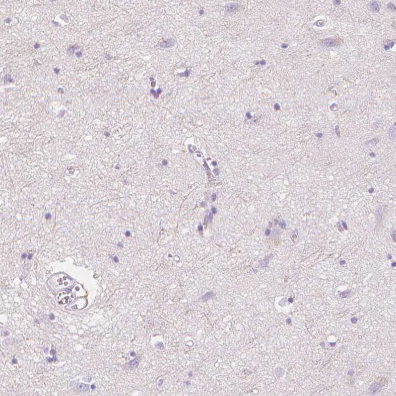 Staining of human cerebral cortex shows no cytoplasmic positivity in neurons as expected.