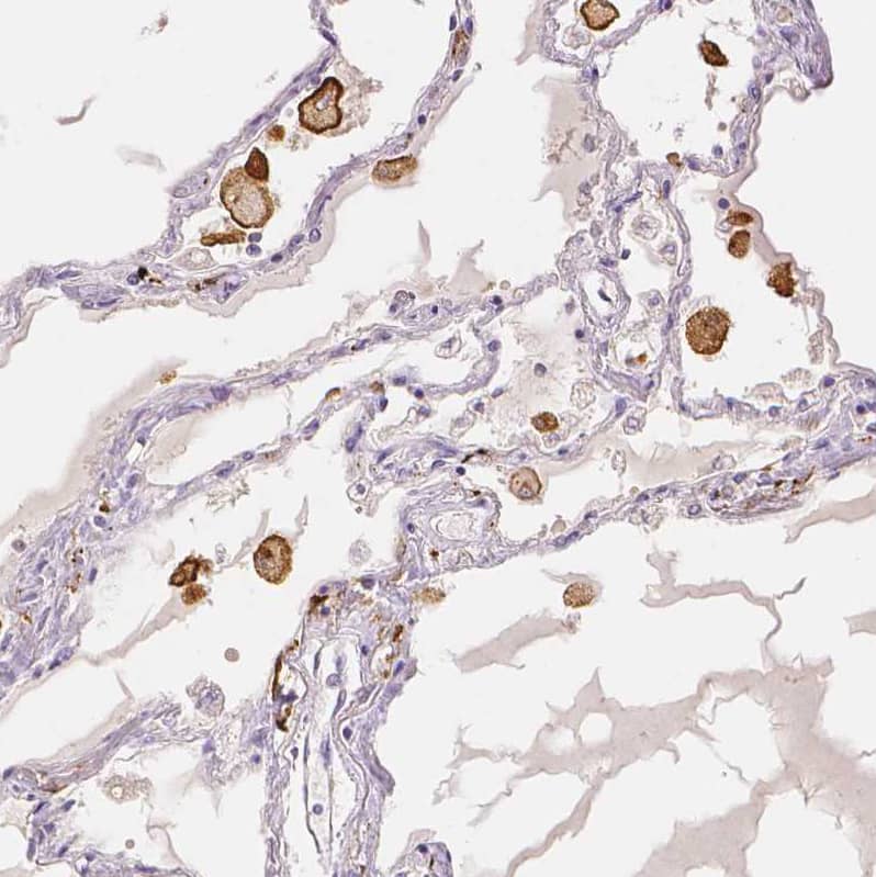 Staining of human lung shows strong cytoplasmic positivity in macrophages.