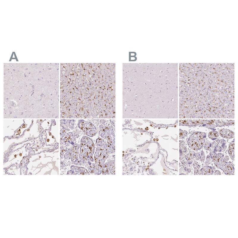 Staining of human cerebral cortex, liver, lung and placenta using antibody NBP2-33439 (A) shows similar protein distribution across tissues to independent antibody NBP1-90020 (B).